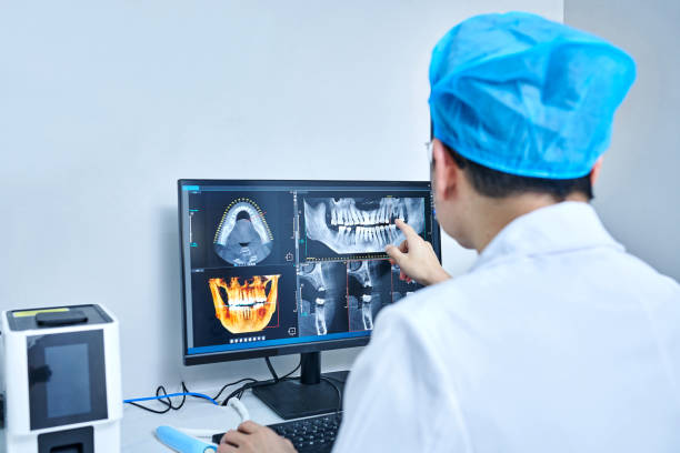 Best Emergency Wisdom Teeth Removal in San Rafael, NM